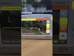 Mindray BeneView T1 患者モニター LCD スクリーン (フロント カバー付き) を選択する理由をご覧ください。