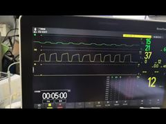 Mindray AG モジュール AG および O2 モジュール MMS モジュール PN 115-023943-00 のデモを見る